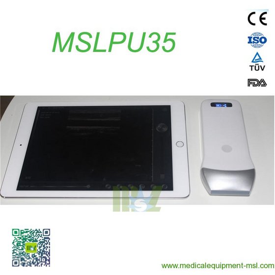 2016 Advanced Wireless Ultrasound Scan Linear Probe MSLPU35