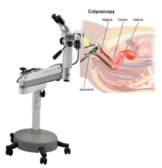 Optic and Electronic Colposcope